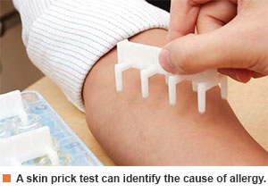 skin prick test to diagnose allergic rhinitis