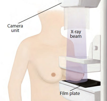 detecting breast cancer with machine