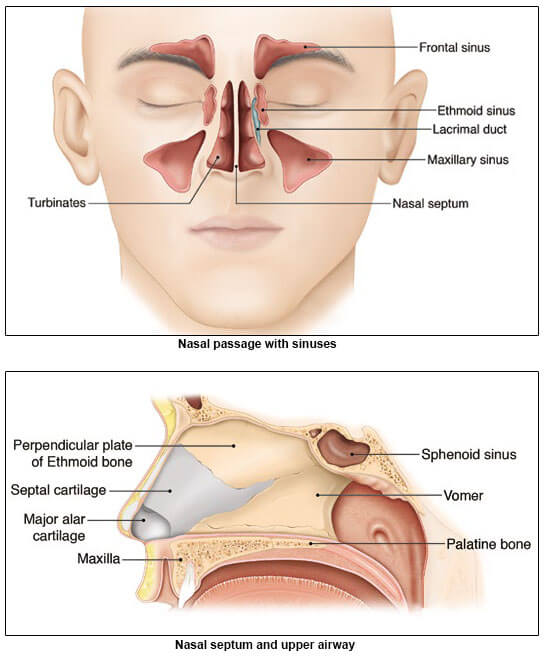 nasal passage of people with obstructive sleep apnoea