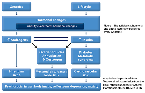 Polycystic Ovary Syndrome (PCOS) features