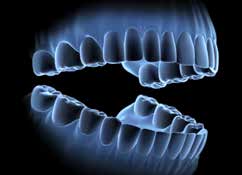 Salivary Gland Infection/Inflammation Sialedenitis can be diagnosed via sialendoscopy. SingHealth Duke-NUS Head and Neck Centre share more.